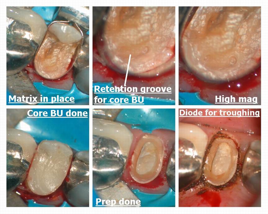 Resize of Premolar recontouring pg 2.jpg